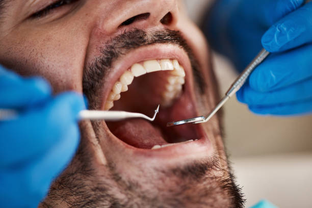 Best Emergency Treatment for Dental Infections or Abscesses in Dasher, GA
