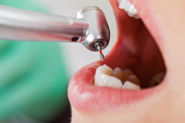 Best After-Hours Dental Trauma Care in Dasher, GA